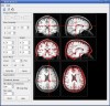 Brain Visualizer
